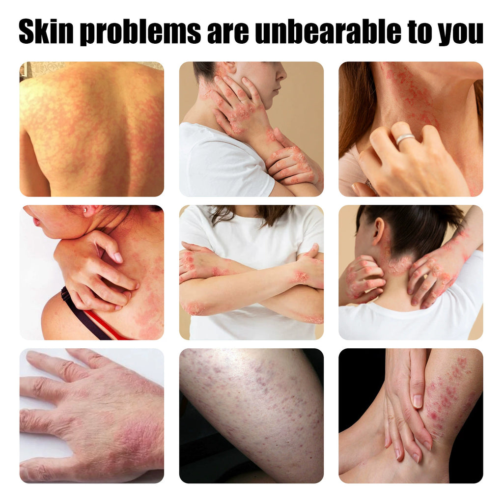 South Moon Skin Care Ointment