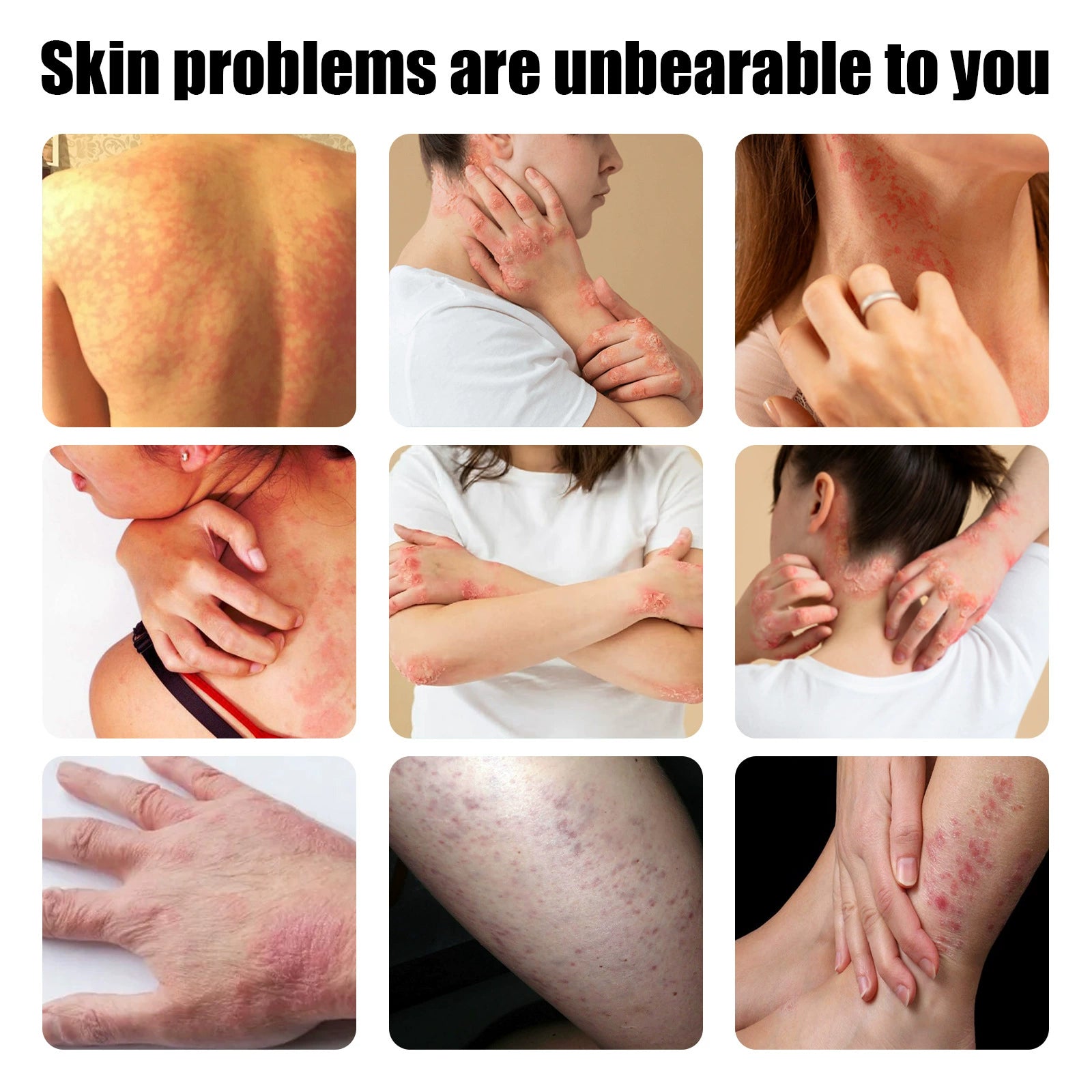 South Moon Skin Care Ointment