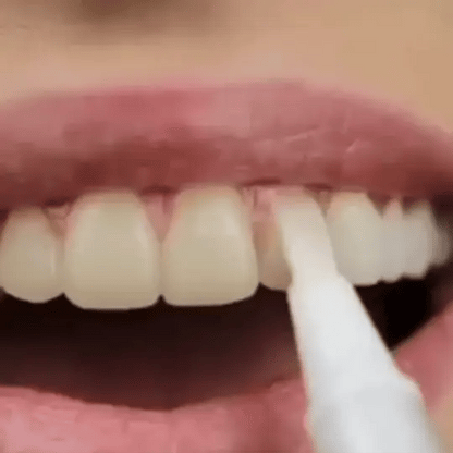 Recommended by renowned dentists:Teeth Whitening Pen