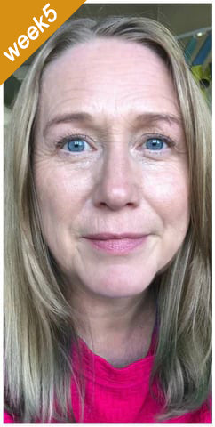 🎅CHRISTMAS HOT SALE-🏆Ends Today: 60% OFF! KLENIMORE™ (Made and Shipped from USA) 🧑‍⚕️Botox Bee Venom Wrinkle Removal Cream