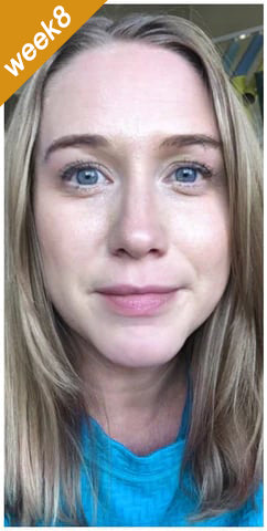 🎅CHRISTMAS HOT SALE-🏆Ends Today: 60% OFF! KLENIMORE™ (Made and Shipped from USA) 🧑‍⚕️Botox Bee Venom Wrinkle Removal Cream