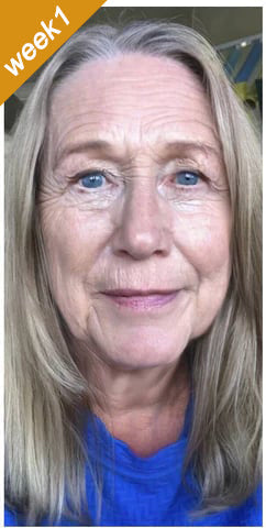 🎅CHRISTMAS HOT SALE-🏆Ends Today: 60% OFF! KLENIMORE™ (Made and Shipped from USA) 🧑‍⚕️Botox Bee Venom Wrinkle Removal Cream