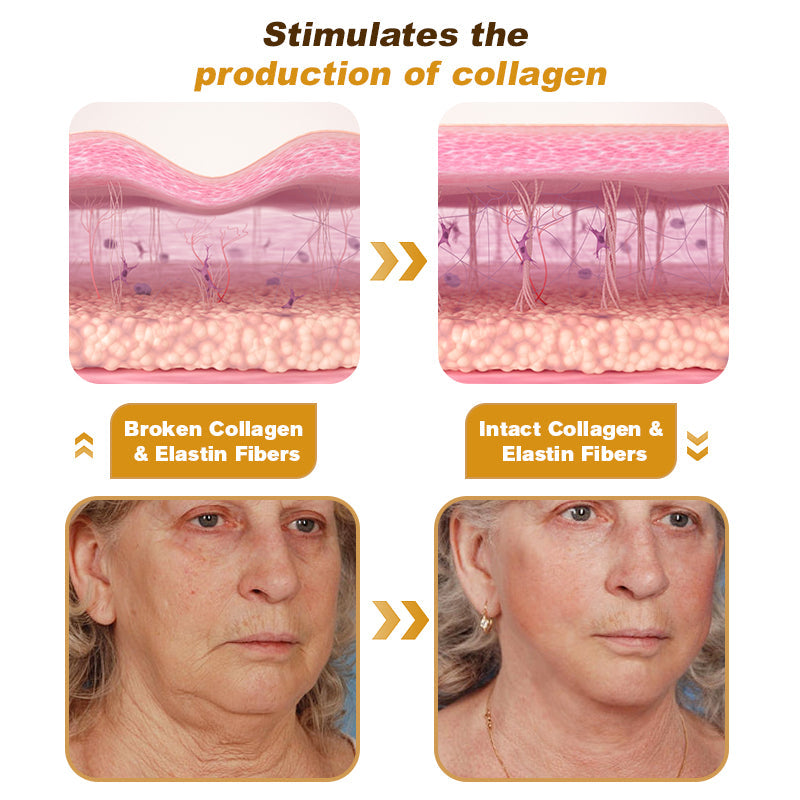 🎅CHRISTMAS HOT SALE-🏆Ends Today: 60% OFF! KLENIMORE™ (Made and Shipped from USA) 🧑‍⚕️Botox Bee Venom Wrinkle Removal Cream